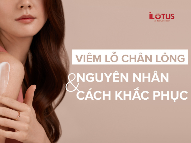 cách trị viêm nang lông